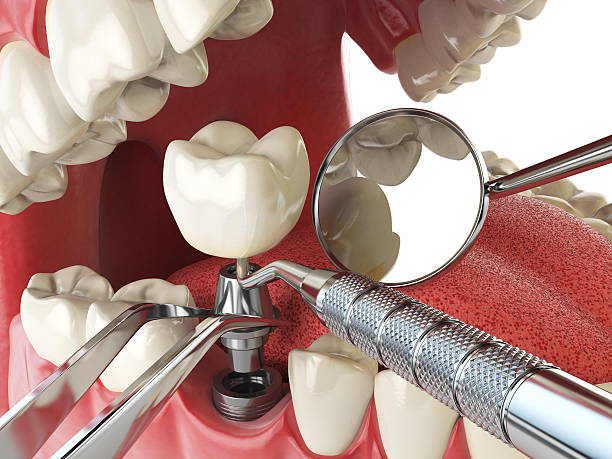 Dentist for Dental Trauma in MI